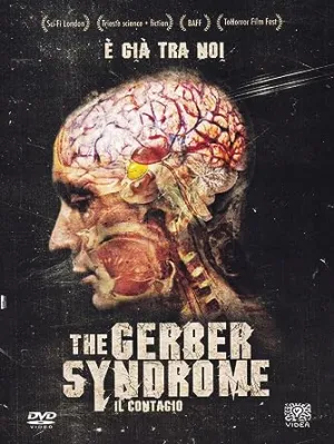 The Gerber Syndrome